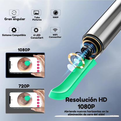 Limpiador de Oídos con Cámara HD